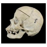 Antique Medical Human Skull.